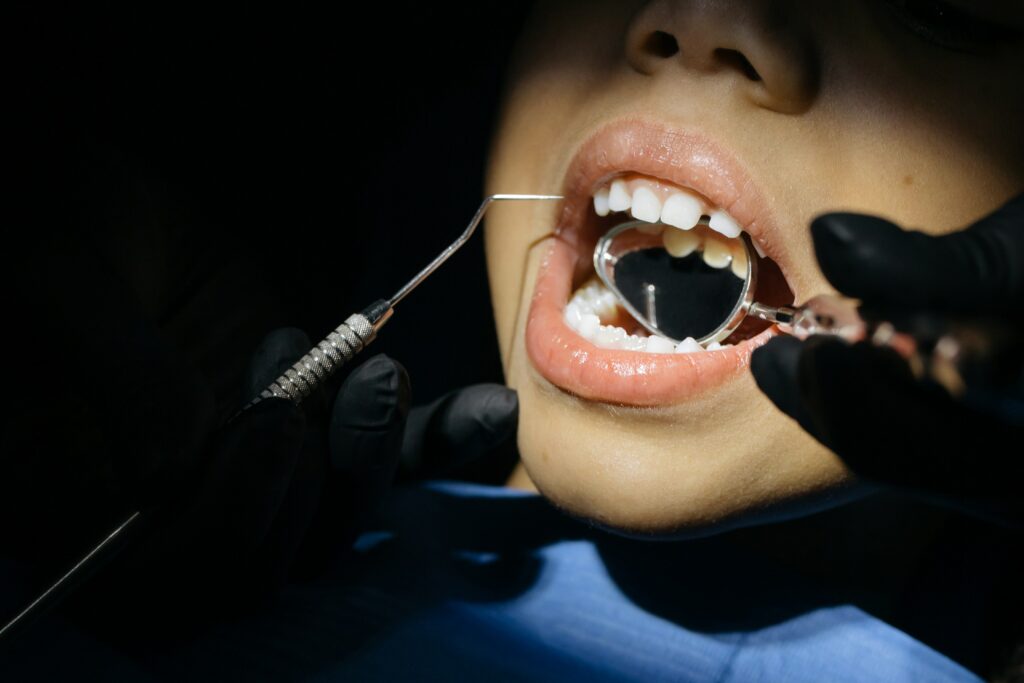 Close-up of a child mid-dental appointment, with the gloved provider’s hands using a hand-held dentistry mirror to look at the back of the child’s teeth. 