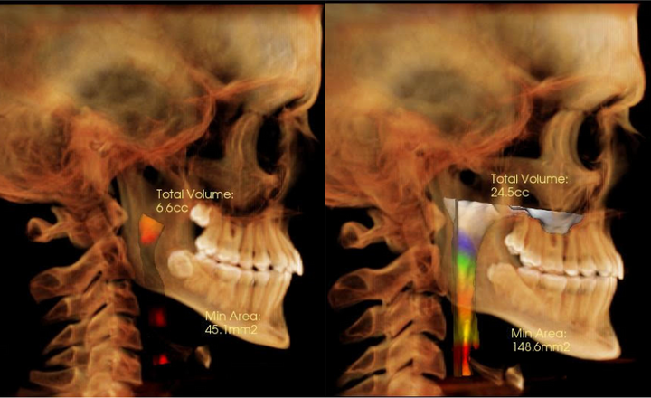Radiograph of Teeth