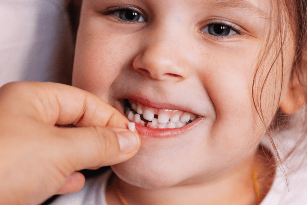 Close-up of a kid smiling with her baby tooth fallen out