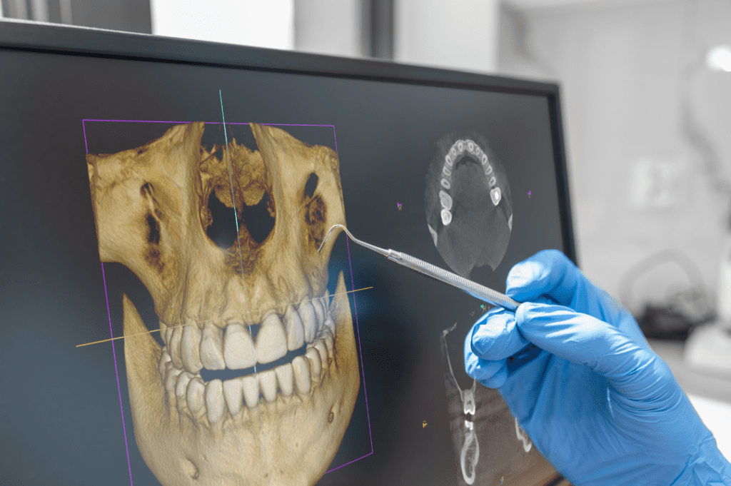 A dentist showing a dental 3D tomography image on screen