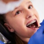 A kid having her teeth with braces get checked by a dentist