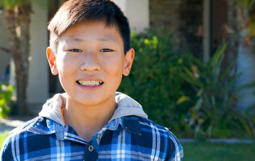 A boy with braces smiling